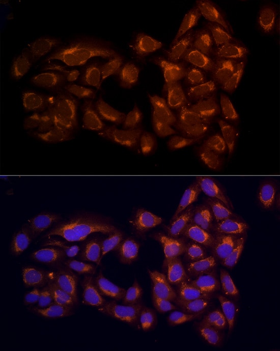 RPH3AL Antibody - BSA Free