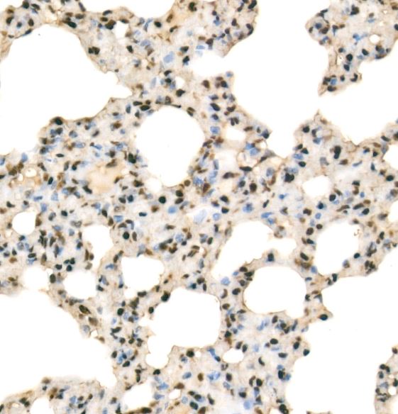 RbAp46 Antibody