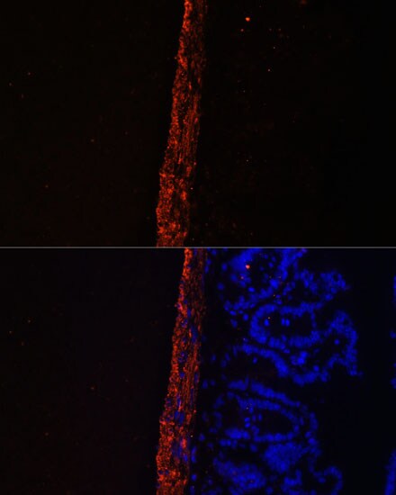MYL9 Antibody - Azide and BSA Free