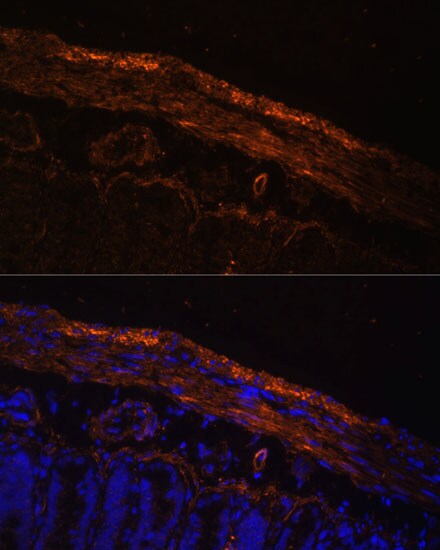 MYL9 Antibody - Azide and BSA Free