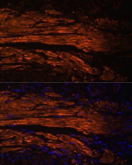 MYL9 Antibody - Azide and BSA Free