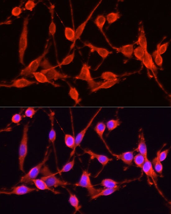 TSG101 Antibody - Azide and BSA Free