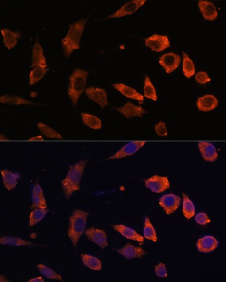Rab5b Antibody - Azide and BSA Free