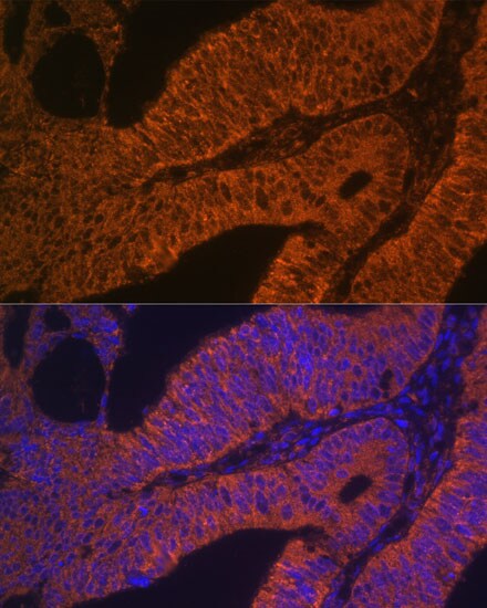 Rab5b Antibody - Azide and BSA Free