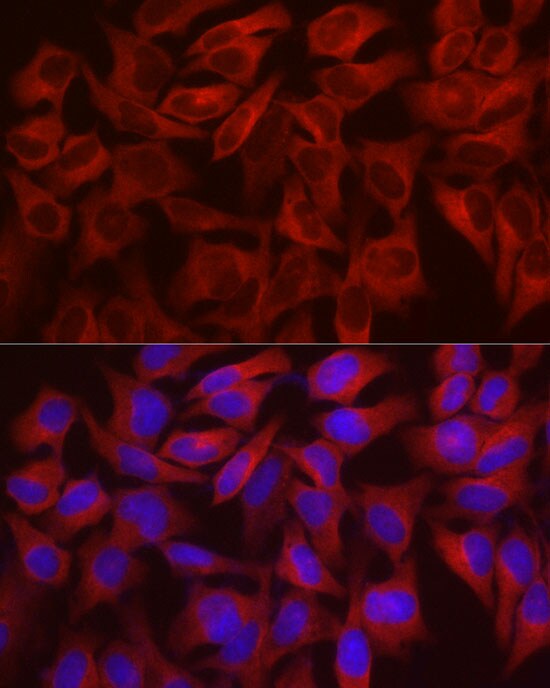 WISP2 Antibody - Azide and BSA Free