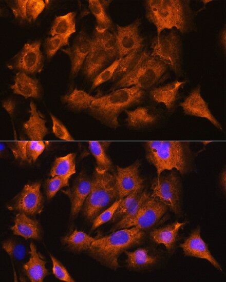 Sodium Potassium ATPase Beta 1 Antibody - BSA Free