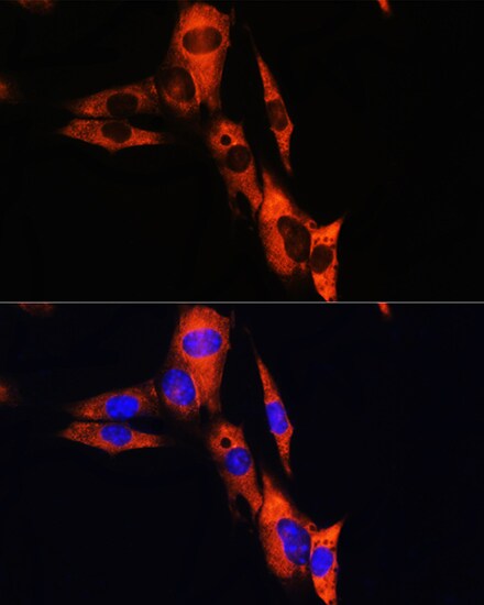 Sodium Potassium ATPase Beta 1 Antibody - BSA Free