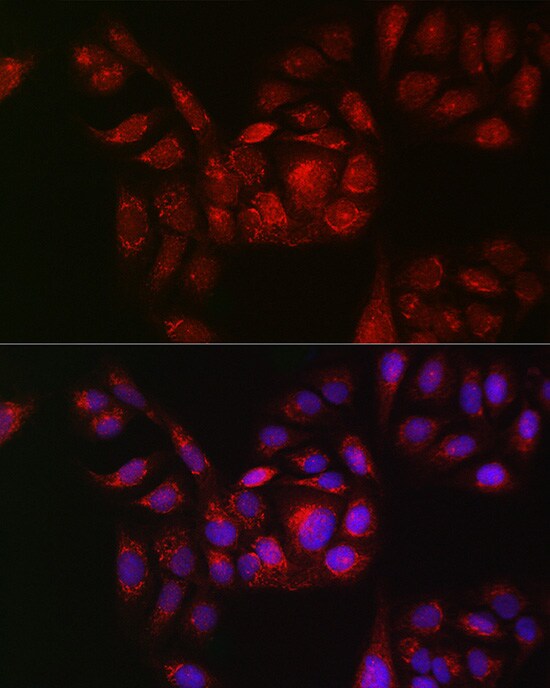 RAB11B Antibody - Azide and BSA Free