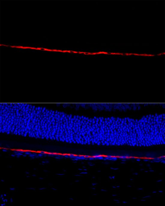 RPE65 Antibody - BSA Free