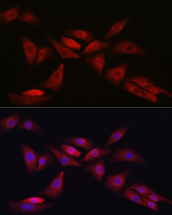 Notch-1 Antibody - Azide and BSA Free