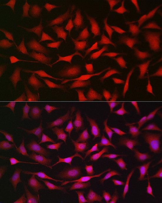 Notch-1 Antibody - Azide and BSA Free