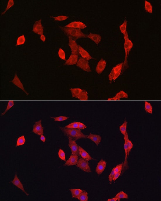 Notch-1 Antibody - Azide and BSA Free