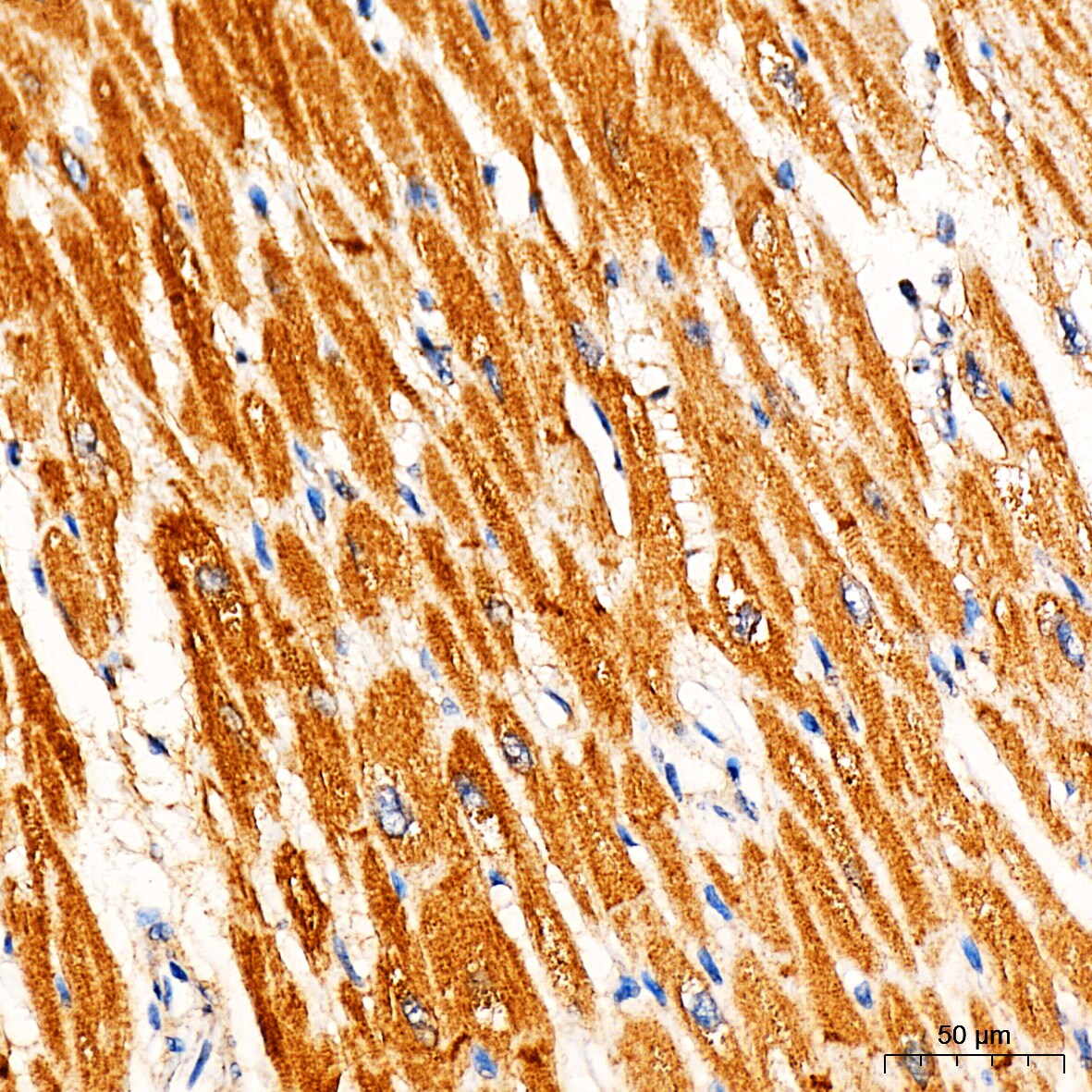 Ryanodine Receptor 2 Antibody - Azide and BSA Free