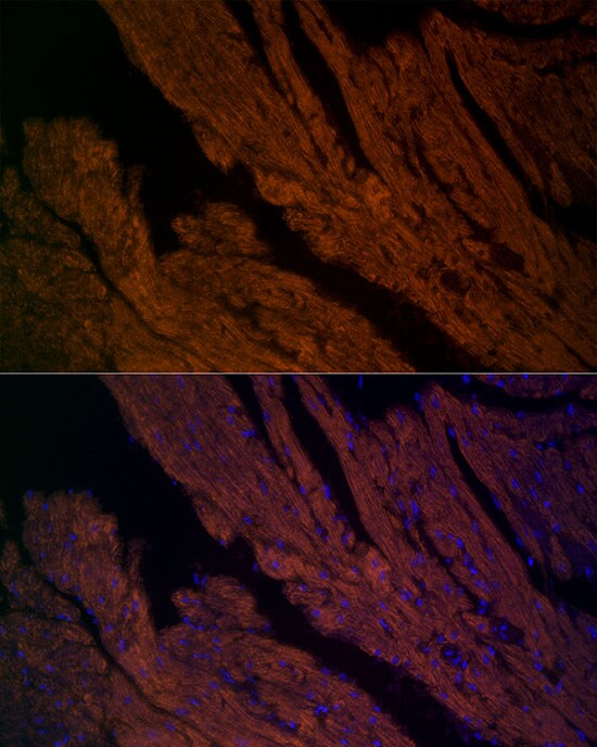 Ryanodine Receptor 2 Antibody - Azide and BSA Free