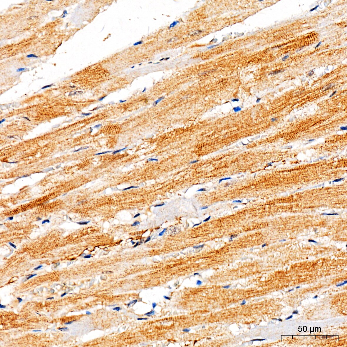Ryanodine Receptor 2 Antibody - Azide and BSA Free