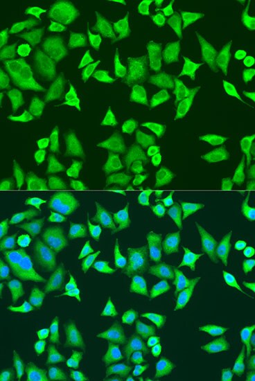 SMN2 Antibody - BSA Free