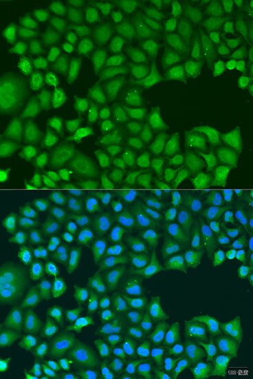 TIRAP Antibody - BSA Free