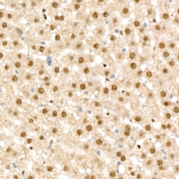 RAD54L2 Antibody - BSA Free