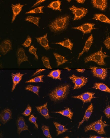 PDHA2 Antibody - Azide and BSA Free
