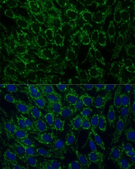 MTIF2 Antibody - Azide and BSA Free