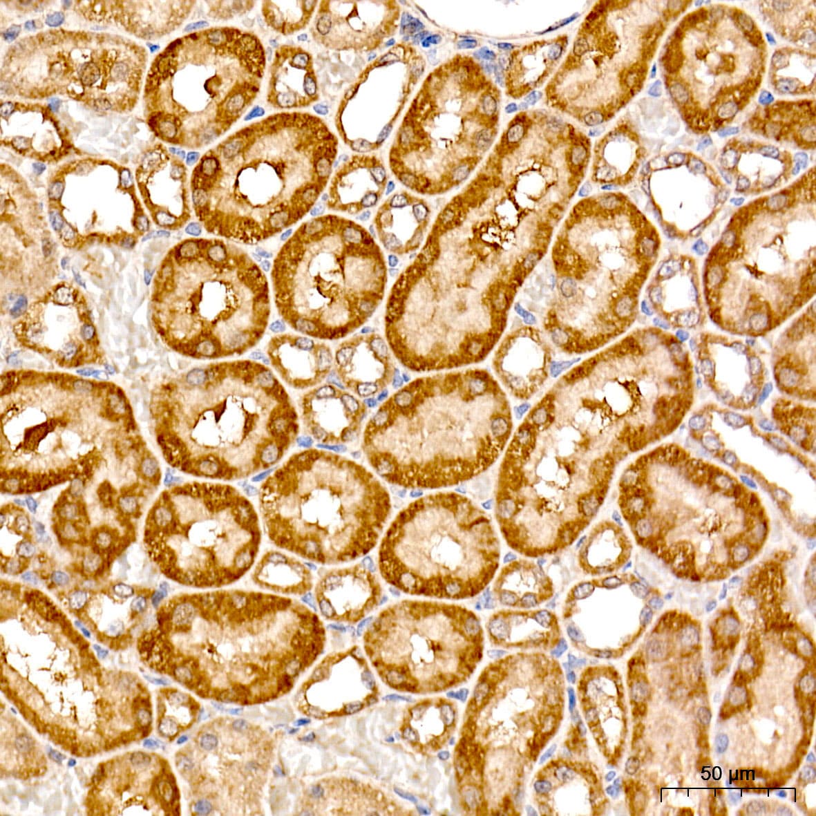 TAT Antibody - BSA Free