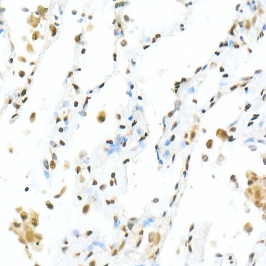 TEAD1 Antibody - Azide and BSA Free