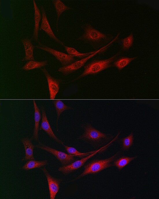 WDR68 Antibody - Azide and BSA Free