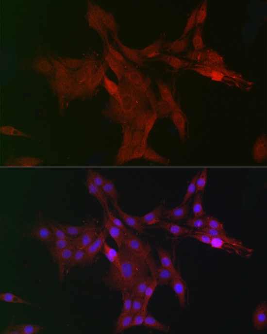 WDR68 Antibody - Azide and BSA Free