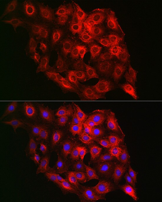 PSMD8 Antibody - BSA Free