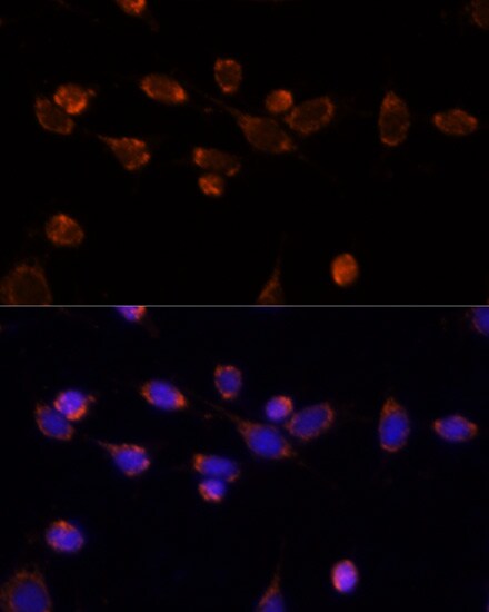 Pyruvate Dehydrogenase E1-alpha subunit Antibody - Azide and BSA Free