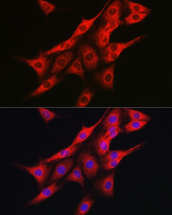 IRE1 alpha Antibody - Azide and BSA Free