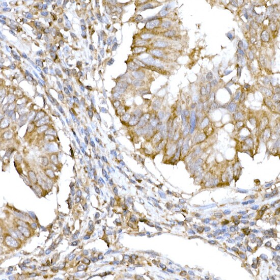 IRE1 alpha Antibody - Azide and BSA Free