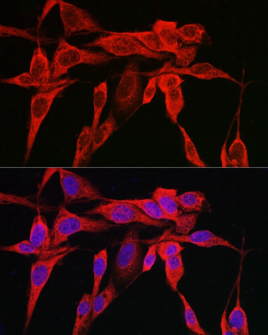 IRE1 alpha Antibody - Azide and BSA Free