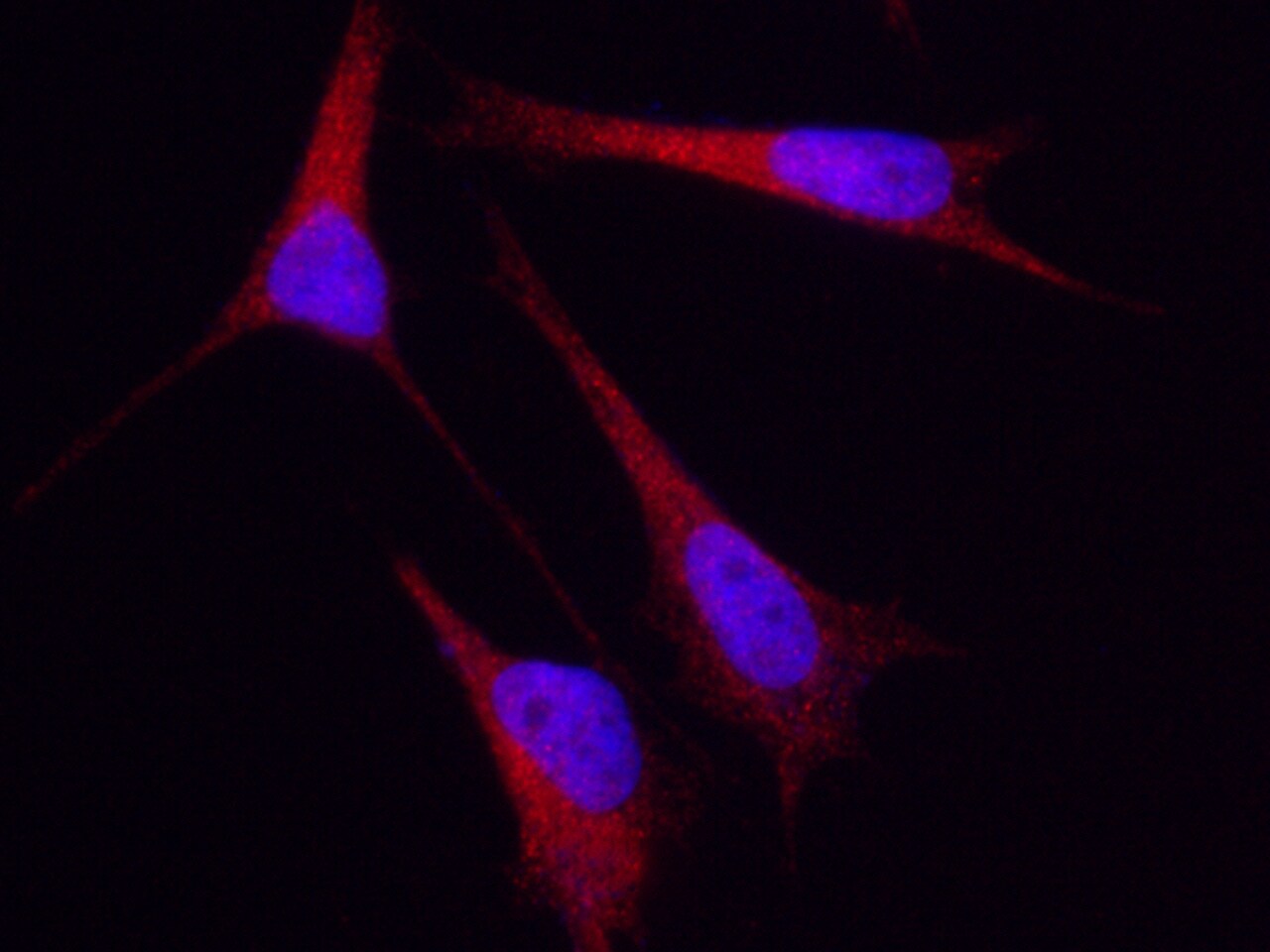 Cytokeratin 5 Antibody - Azide and BSA Free