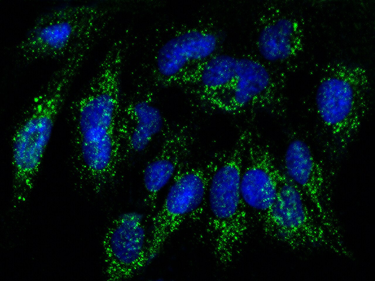 RAB27B Antibody - Azide and BSA Free