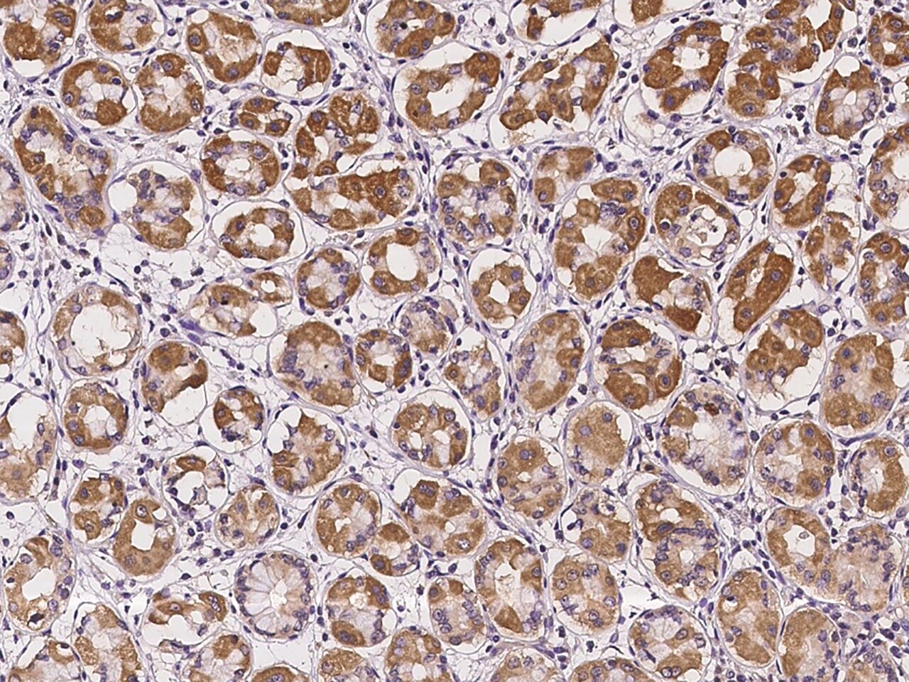 IL18R1 Antibody - BSA Free