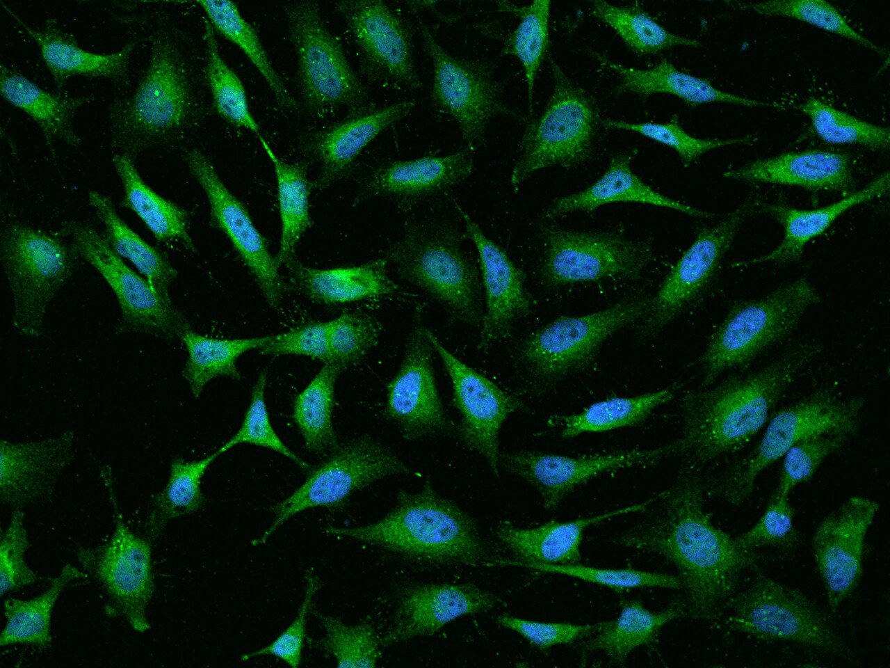 beta-Synuclein Antibody - BSA Free