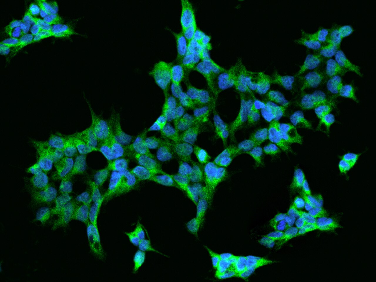 Aminopeptidase A/ENPEP Antibody - BSA Free