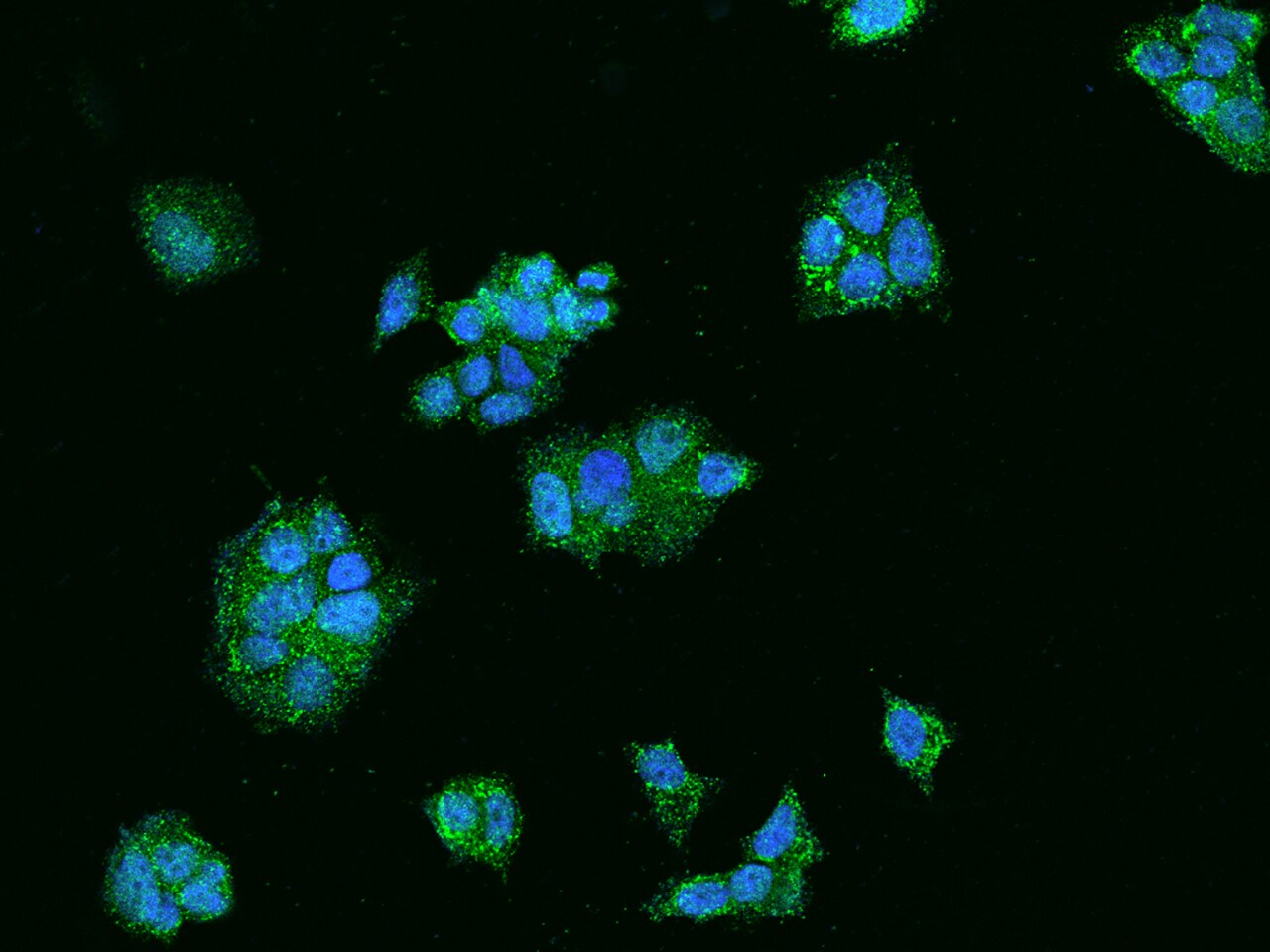 Acetoacetyl CoA synthetase Antibody - BSA Free
