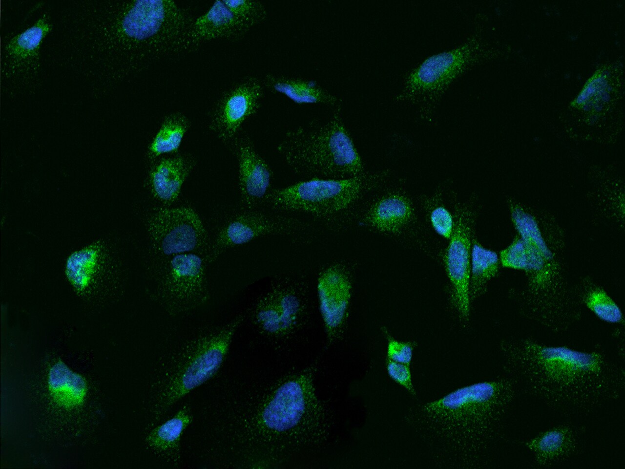 Rab7a Antibody - BSA Free