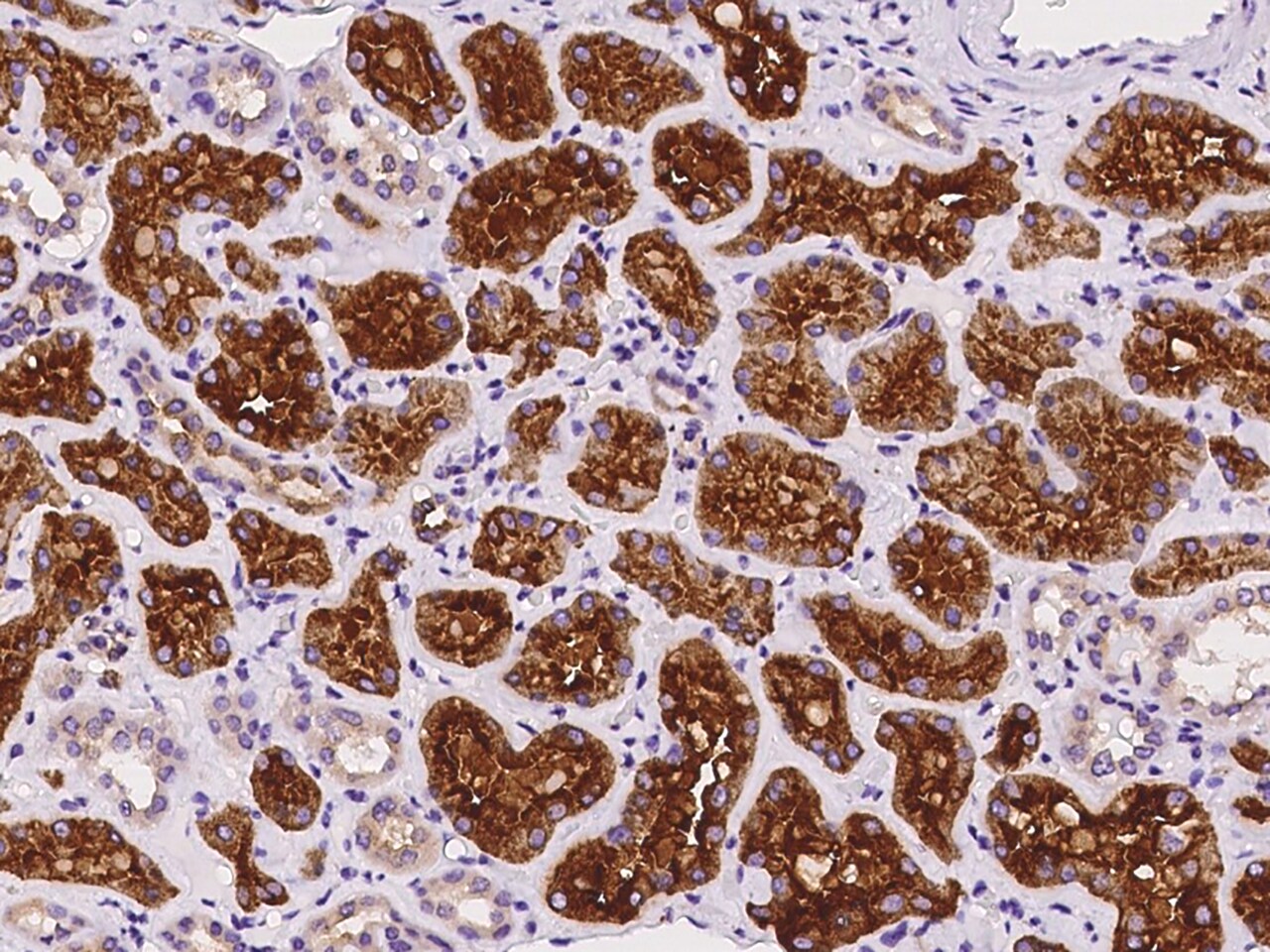 ATP6V1B2 Antibody - BSA Free