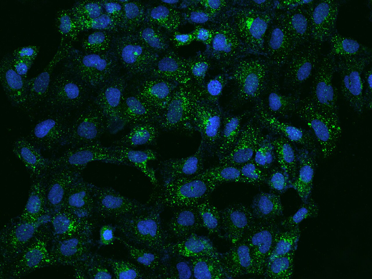 ATP6V1B2 Antibody - BSA Free