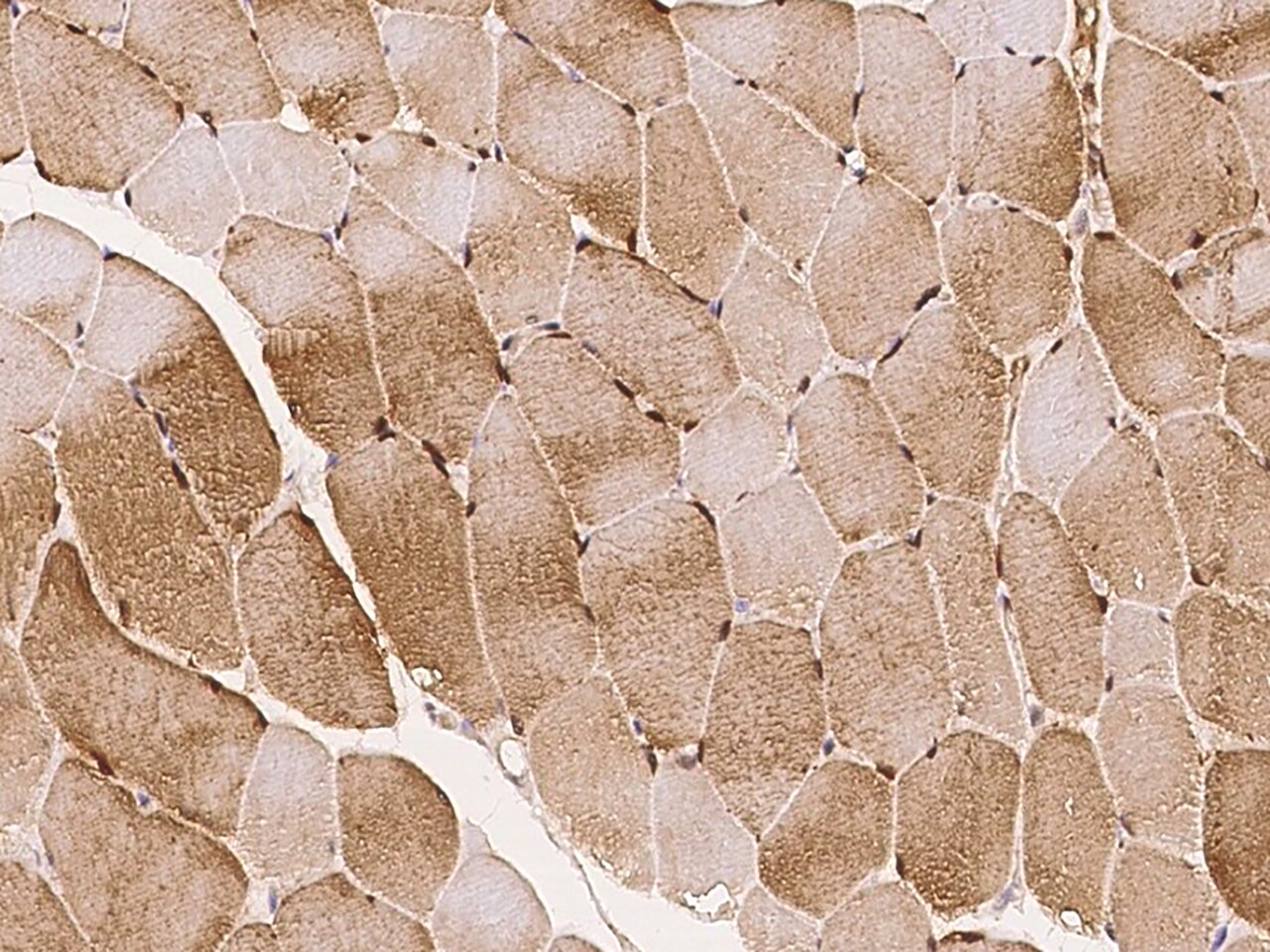 LMCD1 Antibody - BSA Free