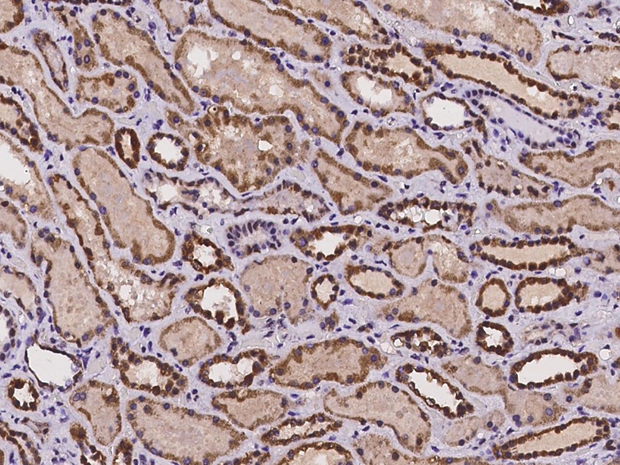 CMC1 Antibody - BSA Free