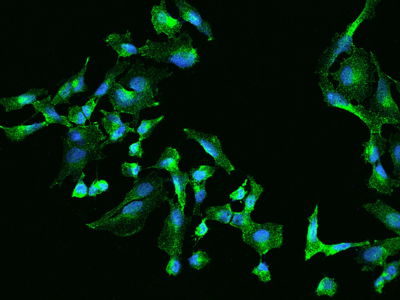 Clathrin light chain Antibody - BSA Free