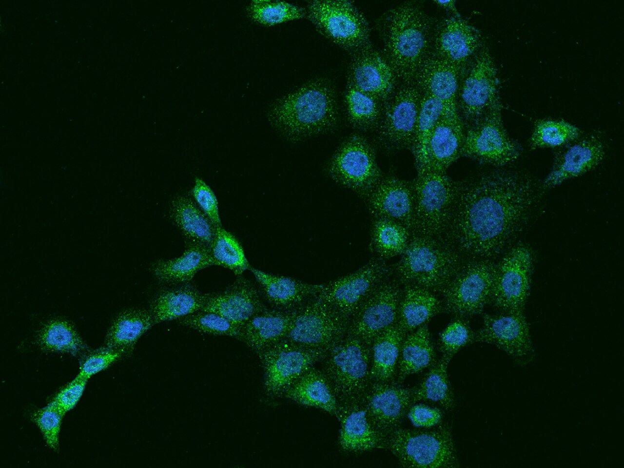 Dynactin Subunit 2/DCTN2/DCTN-50 Antibody - BSA Free