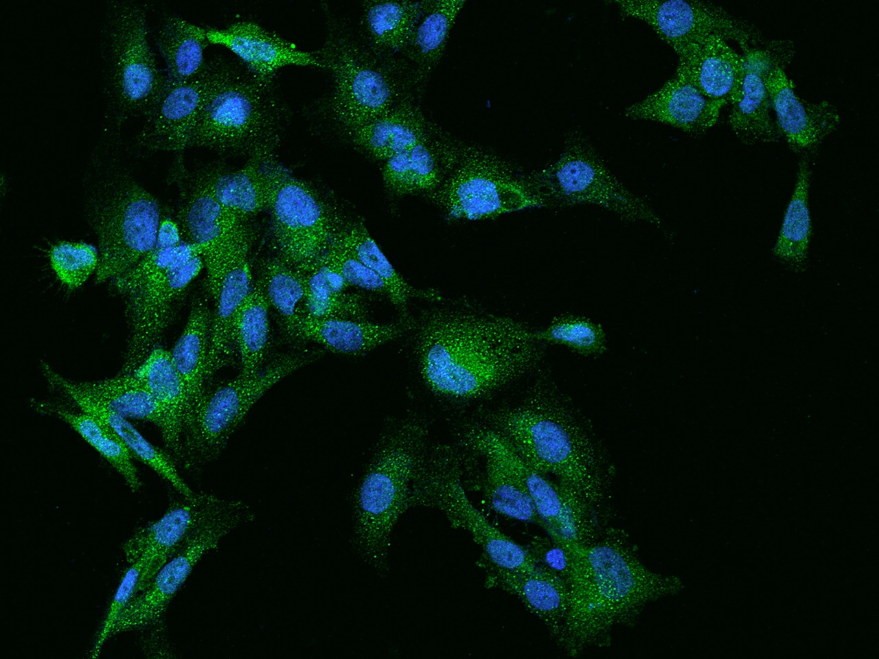 Rabex5 Antibody - BSA Free