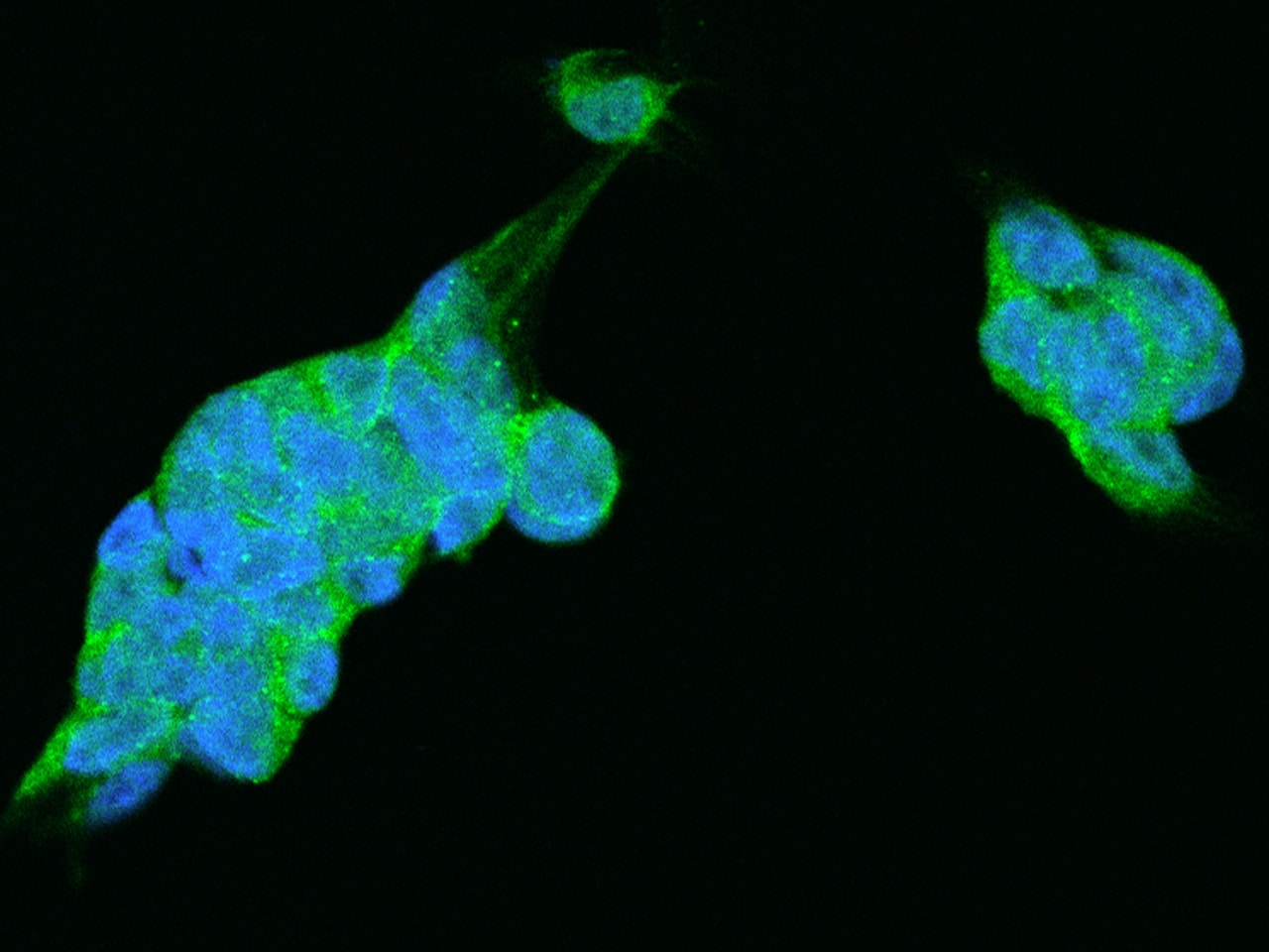Proteasome 19S S7 Antibody - BSA Free