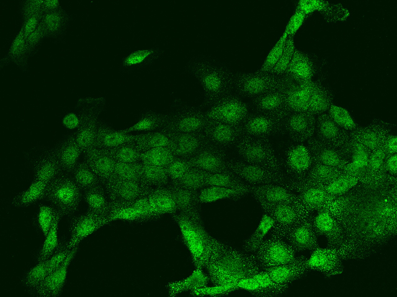PLA2G4F Antibody - BSA Free