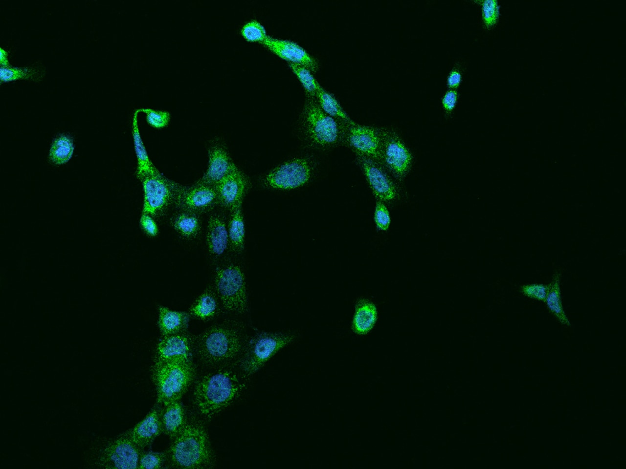 SUCLG1 Antibody - BSA Free